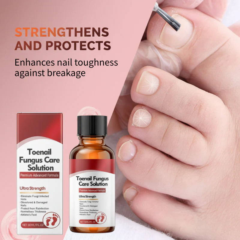 Lumen & Co. Toe Nail Fungus Solution