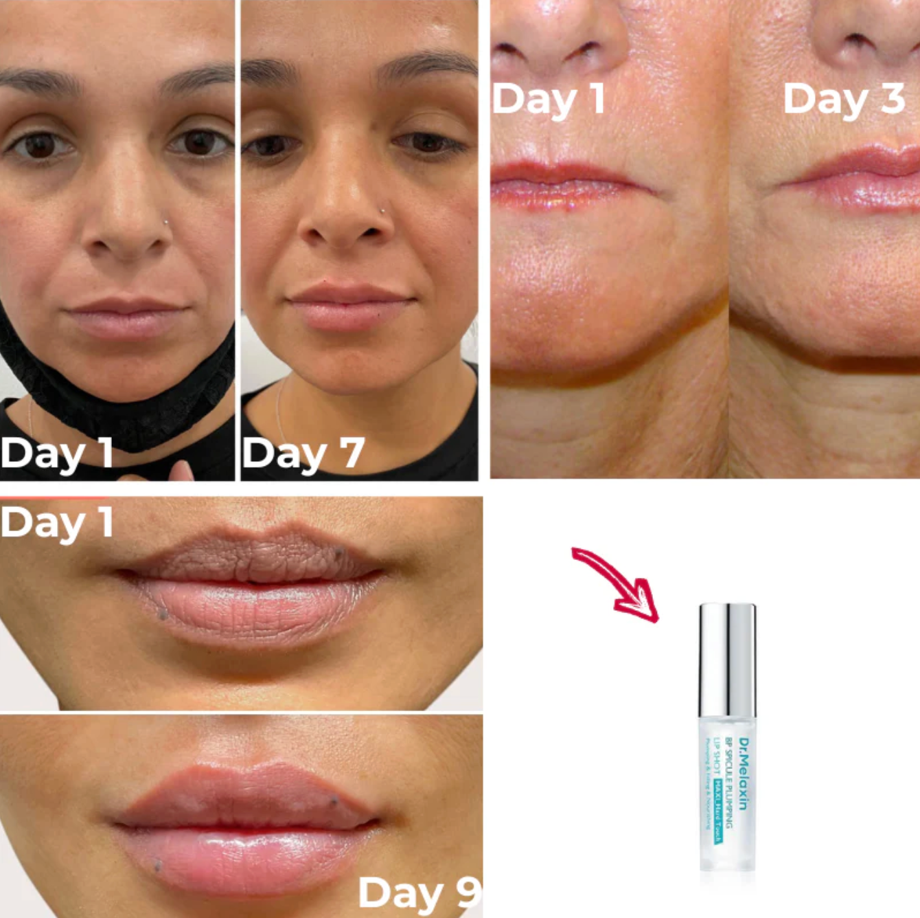 Spicule Lip Plumping Serum