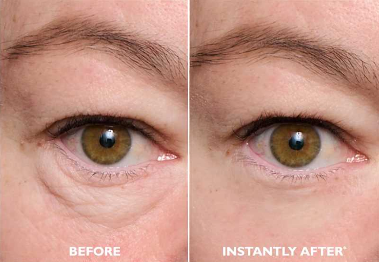 LumiLift Instant Tightener