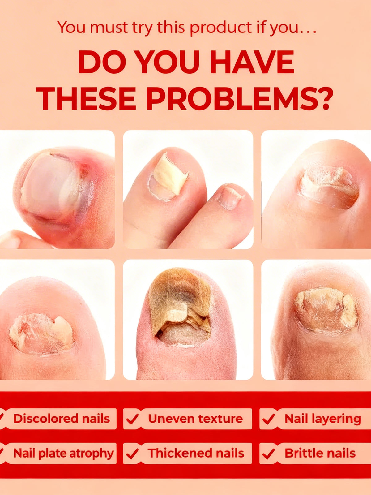 Lumen & Co. Toe Nail Fungus Solution